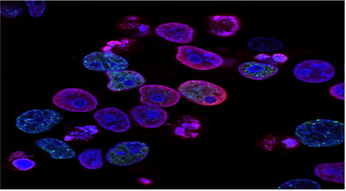 Novel Drug Combination Trial Offers Hope for Advanced Prostate Cancer Patients