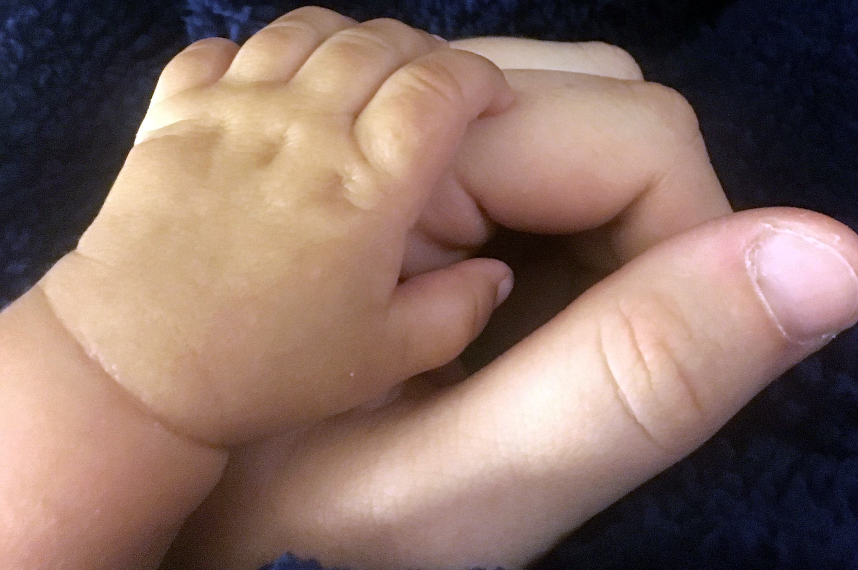 Study Links Congenital Heart Defects to Increased Childhood Cancer Risk