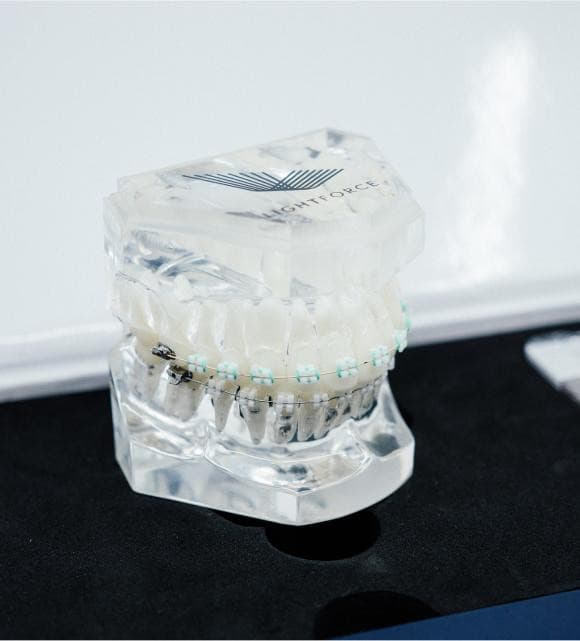 TG Orthodontics Introduces Customized Lightforce Braces for Personalized Treatment