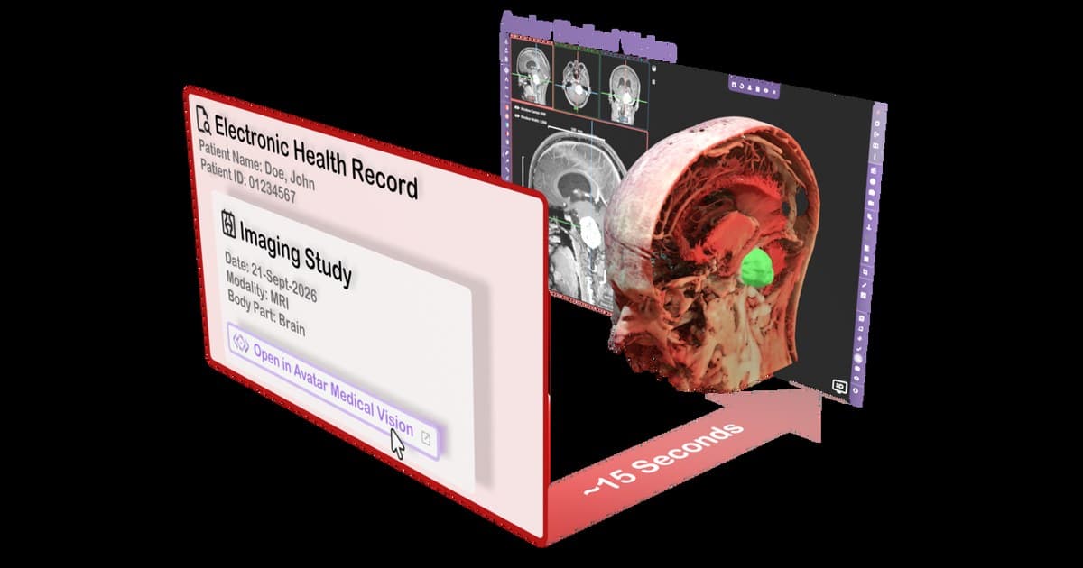 Avatar Medical Integrates Patient-Specific 3D Imaging into Epic EHR for Faster Clinical Access