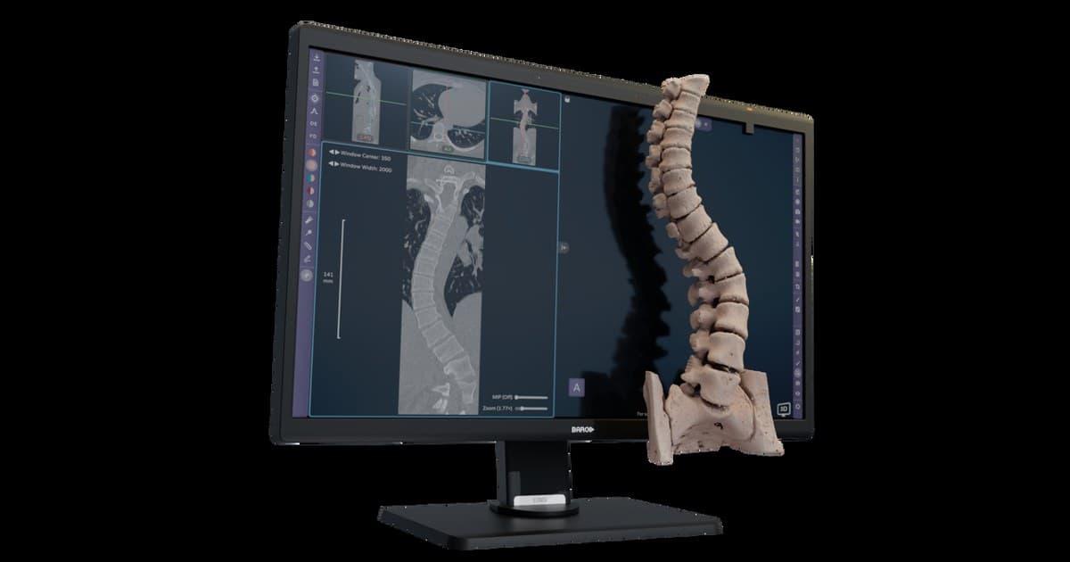 Avatar Medical Vision Earns CE Mark for Glasses-Free 3D Surgical Planning